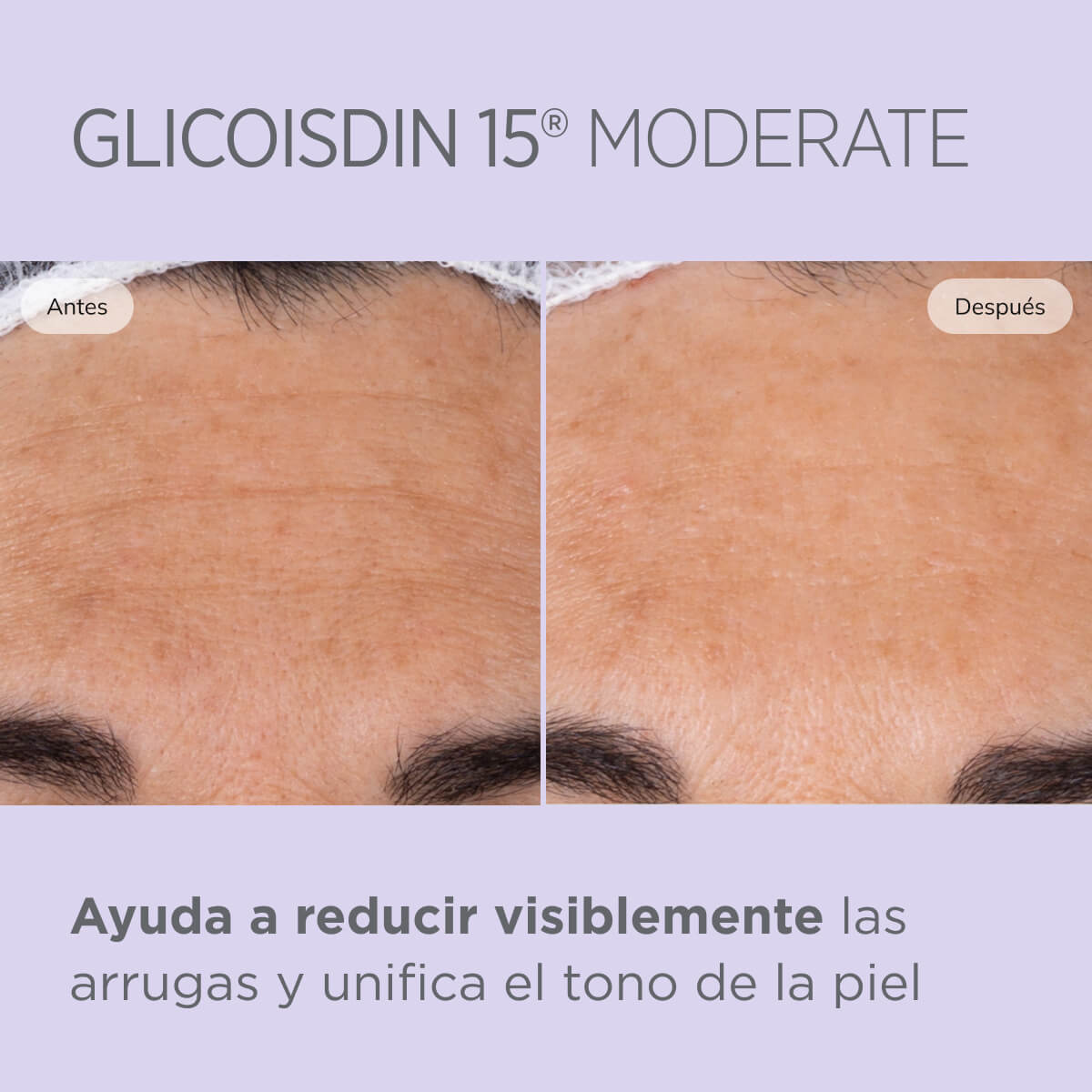 Isdinceutics Glicoisdin 15 Moderate
