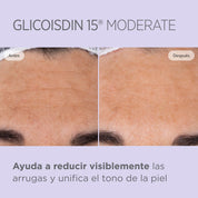 Isdinceutics Glicoisdin 15 Moderate